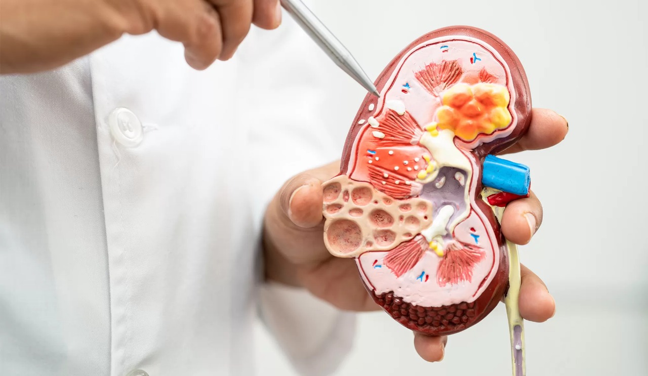 Best Doctor for kidney disease in Greater Noida